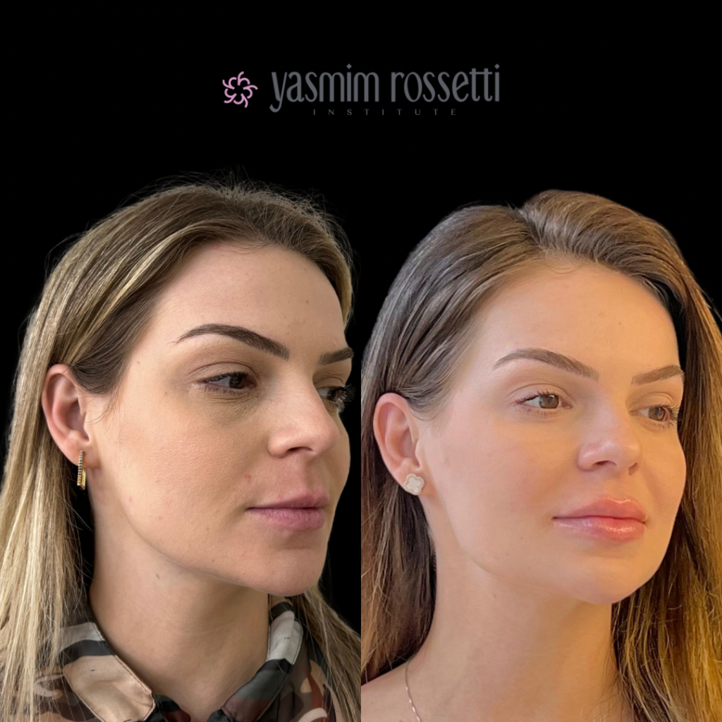 19_Antes x Depois (cursos) - 5